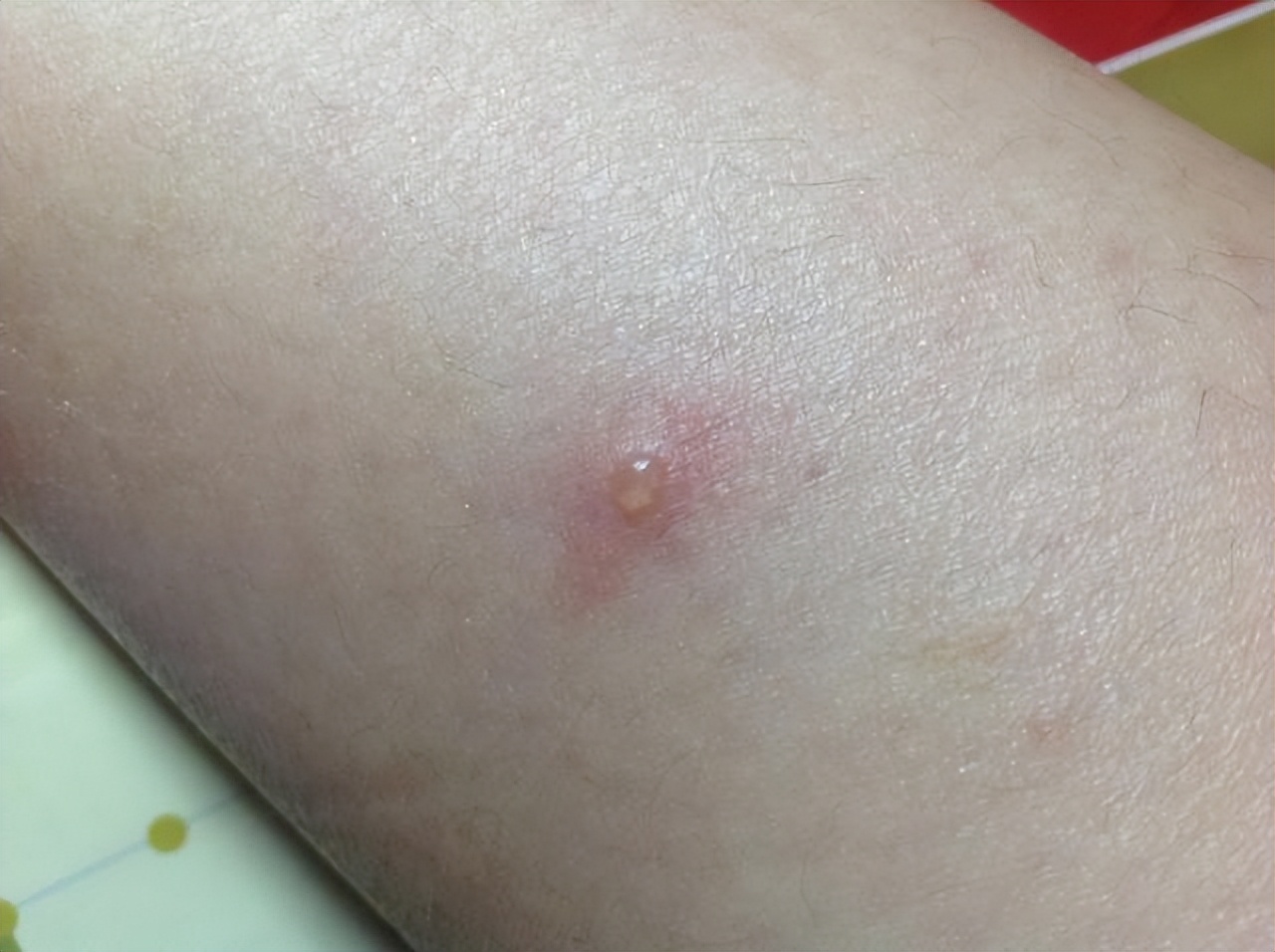 “阿莫西林”要看清，只对这6种病有效，不同疾病要区别对待