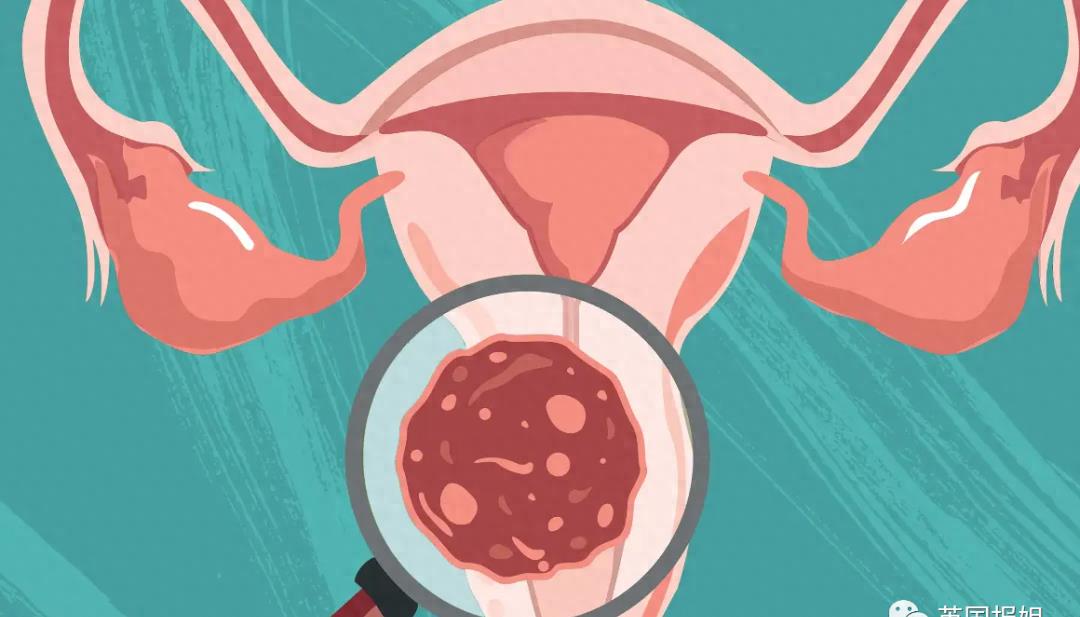 全球最美女人之一去世，仅26岁！曾在中国参加选美比赛，外网悼念