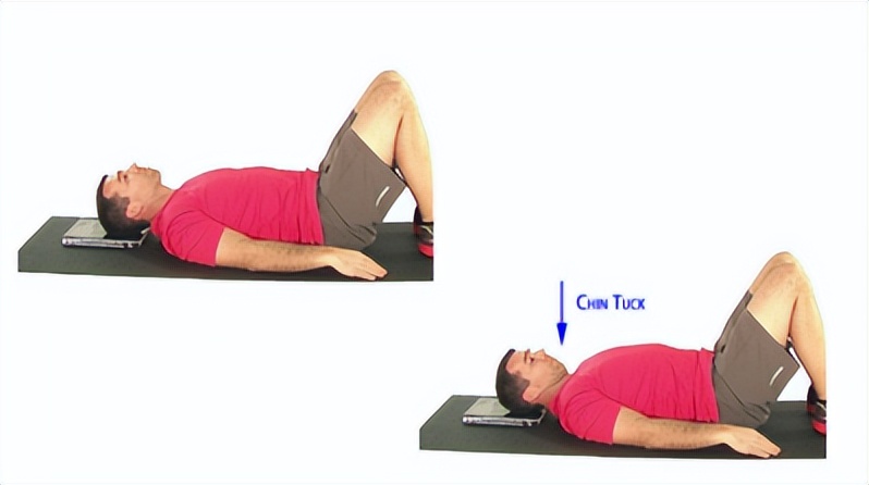 颈复康治疗颈源性头痛吗,颈源性头痛整体解决方案