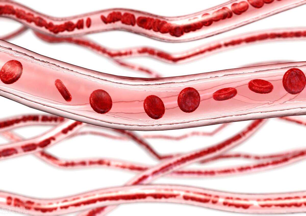 拔火罐的瘀血是身体内的毒素吗,拔火罐拔出的淤血是体内的毒素吗