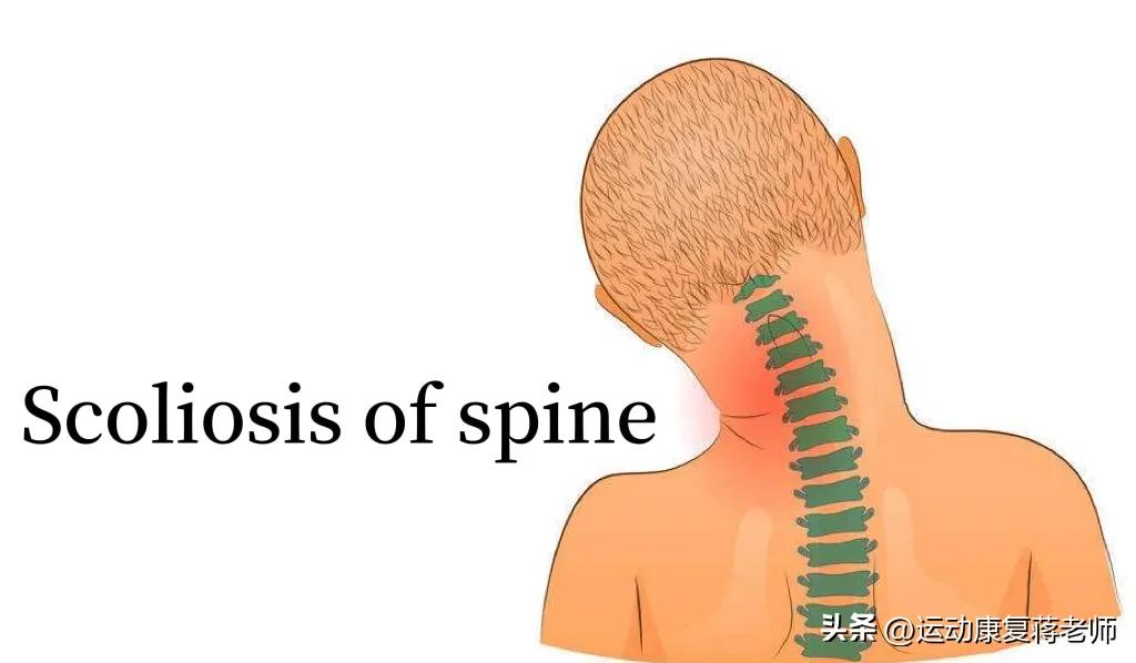 脖子歪左边怎么矫正,脖子歪了睡觉应该注意啥姿势