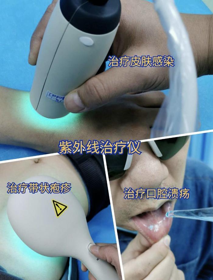 邯郸市第二医院疼痛科新引进紫外线治疗仪