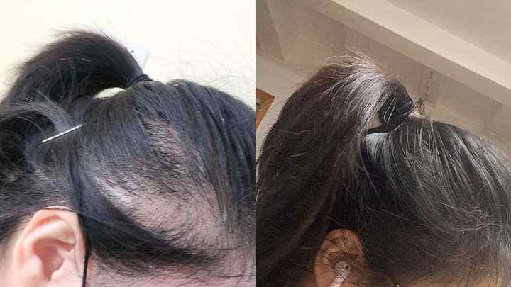 防脱洗发水好文,防脱洗发水用一次有没有事