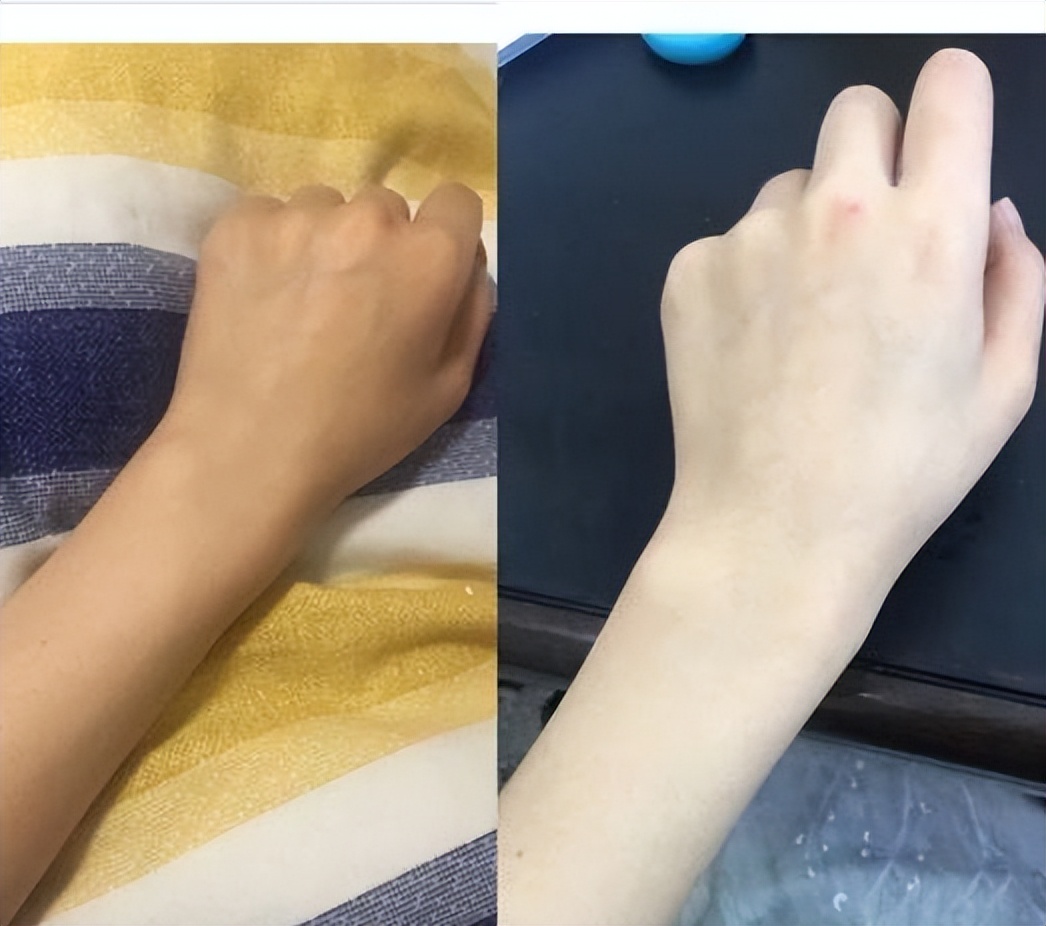 如何从黄黑皮逆袭冷白皮,如何从黄黑皮逆袭冷白皮男