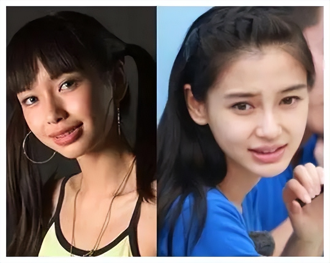 轻微嘴凸法令纹真的让人很自卑,法令纹严重是因为嘴凸吗