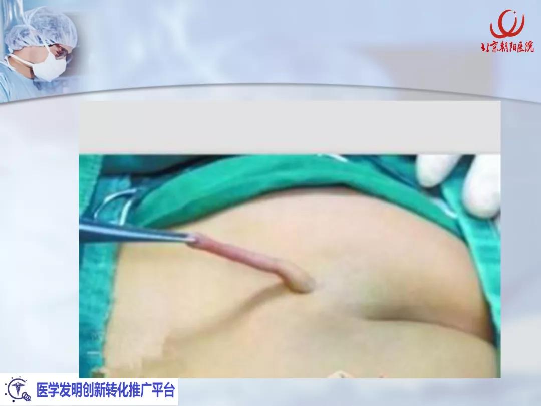 课件分享丨腰硬联合麻醉后，患者脑脊液持续漏出，怎么办？