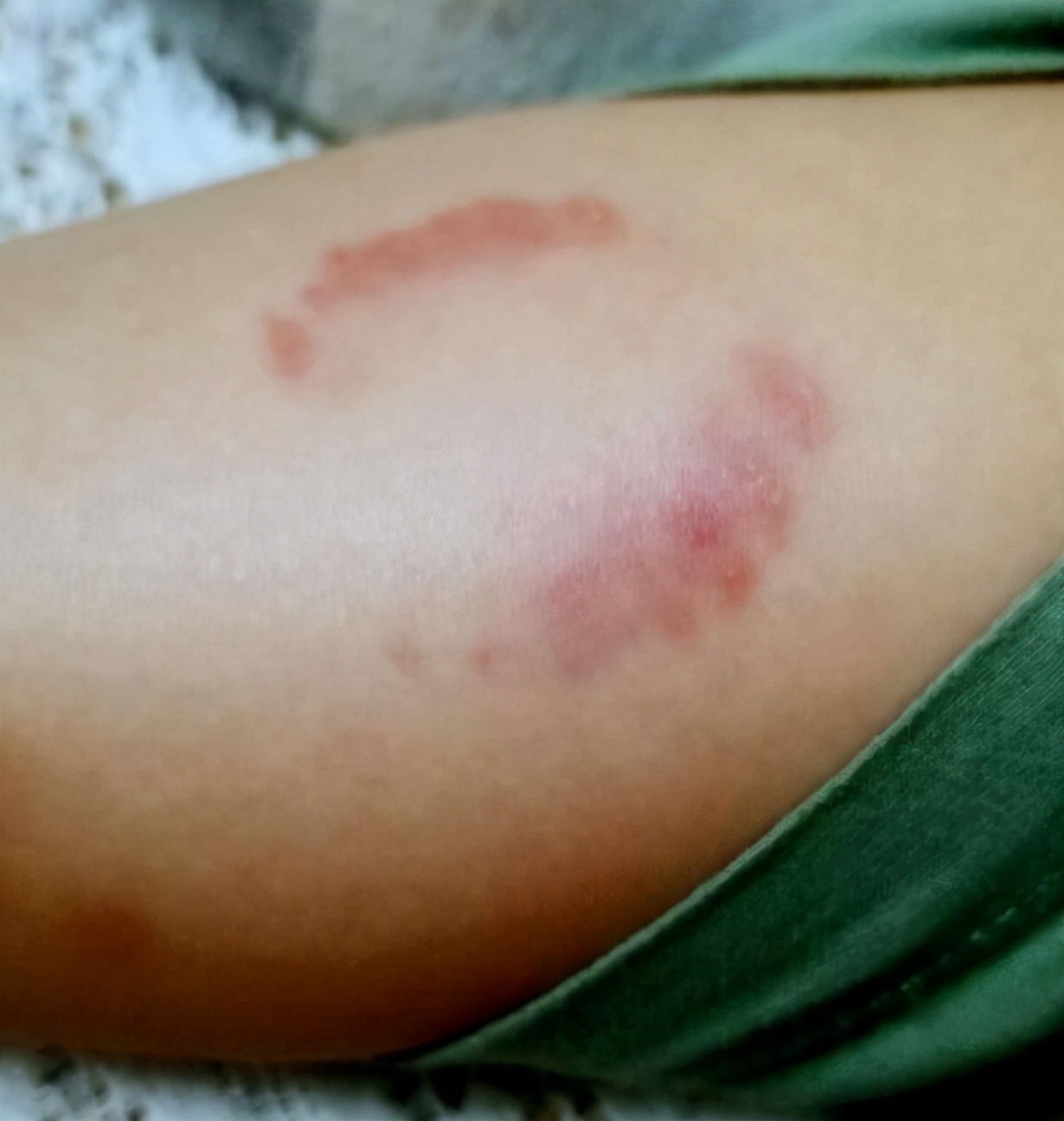 宝宝爱咬人爱抓人怎么办,宝宝喜欢咬人打人怎么纠正