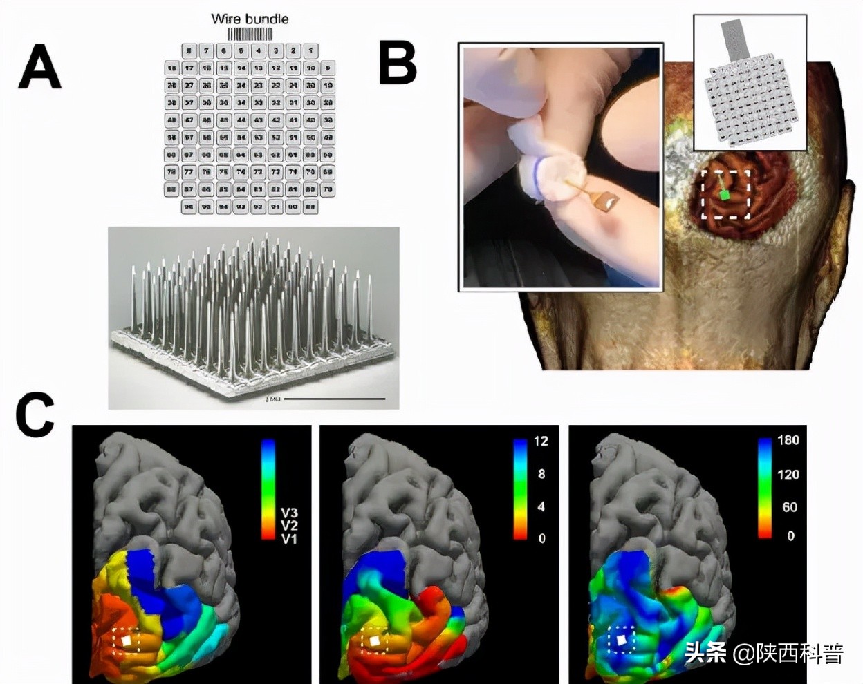 眼睛光斑闪烁,揉眼睛时为什么会出现光斑图案