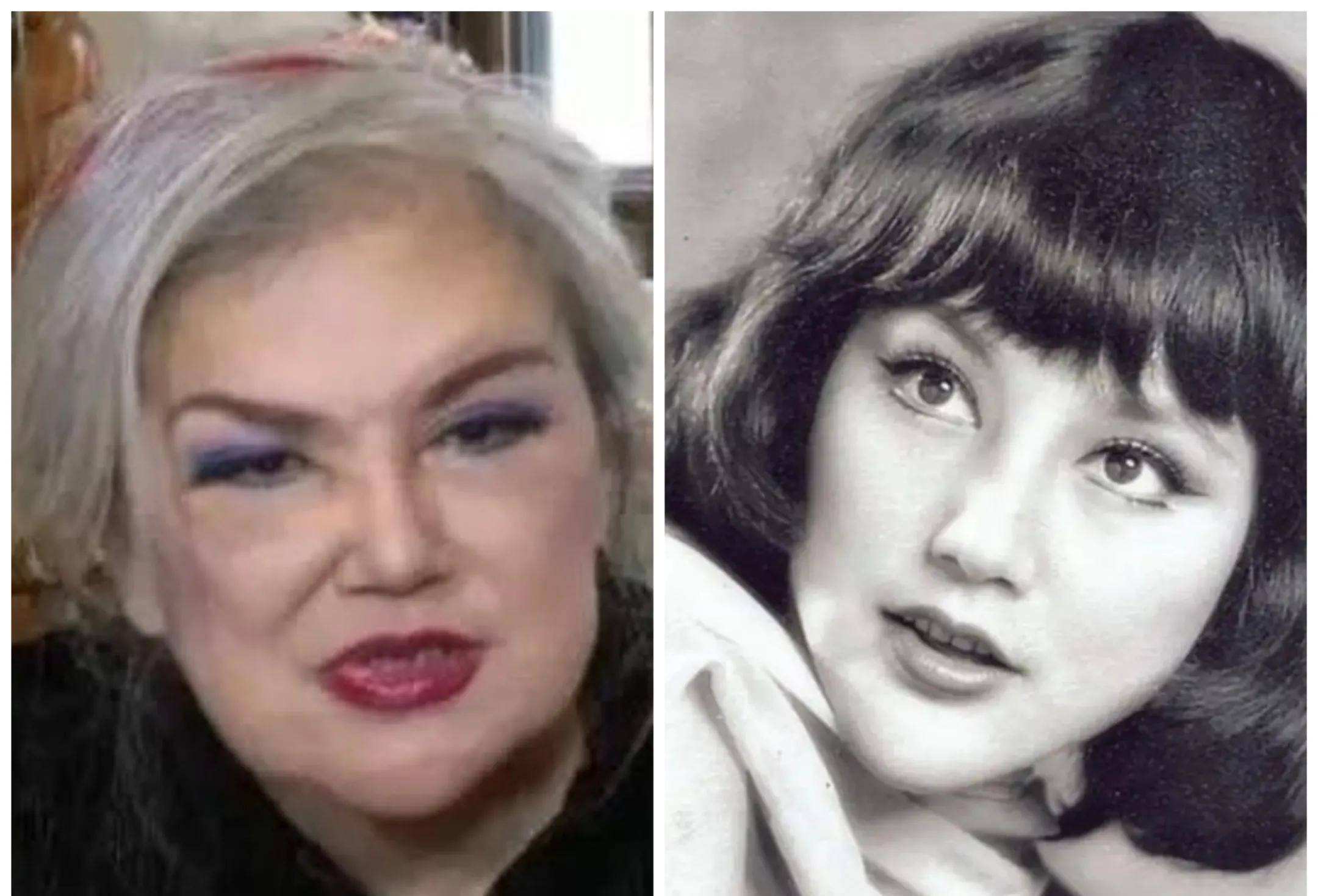 最失败硅胶脸的女星,硅胶脸女明星排行