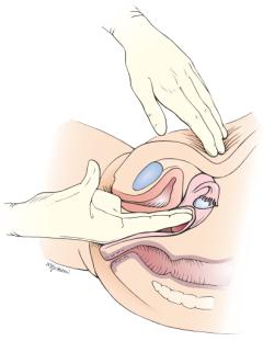 体检妇科不过怎么办,体检中哪些妇科病不用治