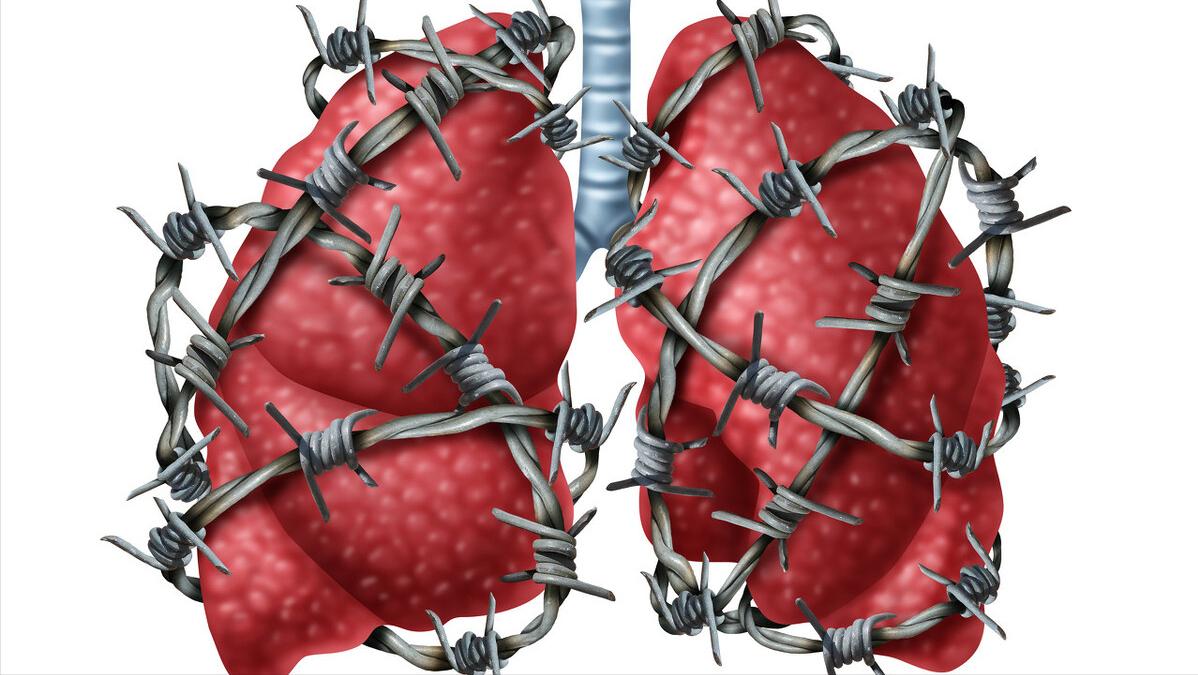 肺纤维化咳嗽有什么影响,感冒咳嗽会引起肺纤维化吗