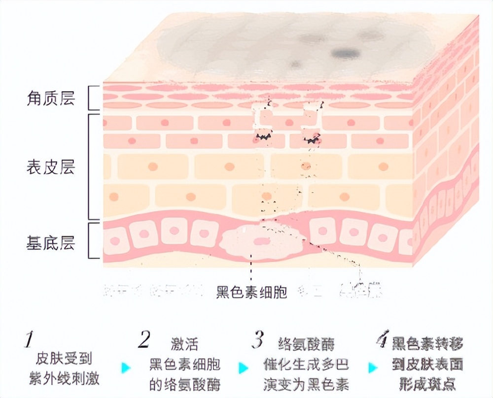 芮一美白淡斑面膜,泰国芮一蚕丝面膜效果怎样