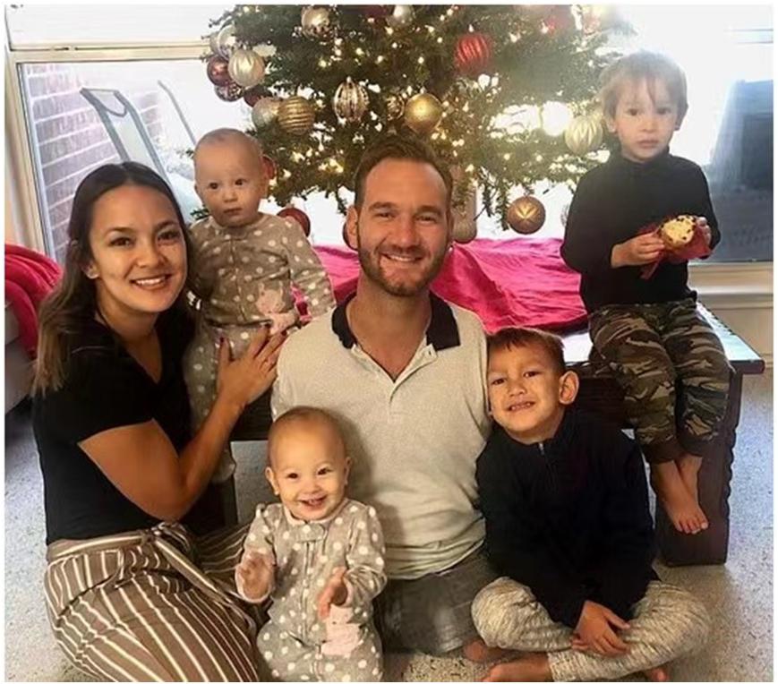 没有四肢的人中国,没有四肢人可以活吗