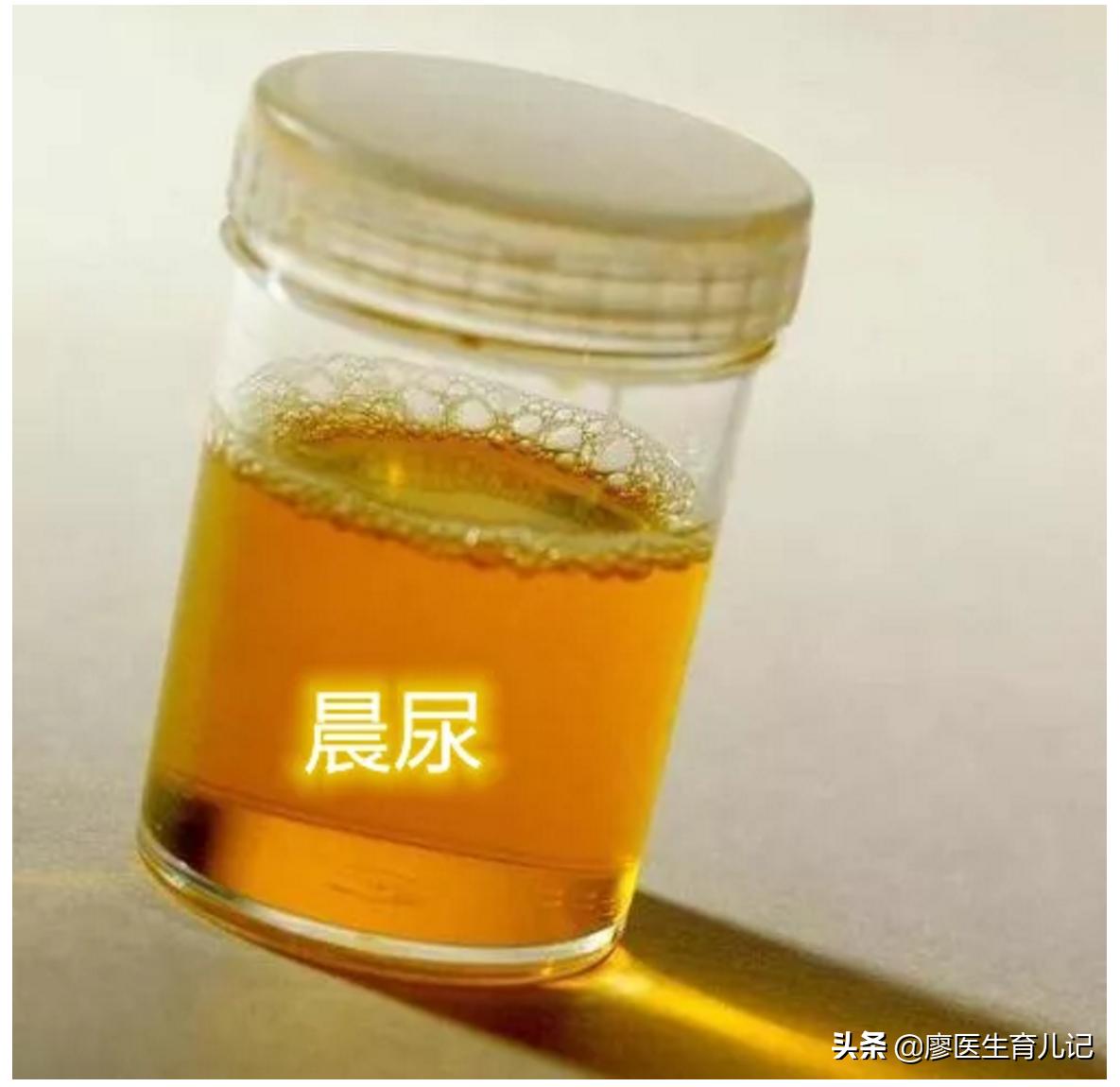 尿液颜色常识图解,孕妇尿液分为哪几种颜色