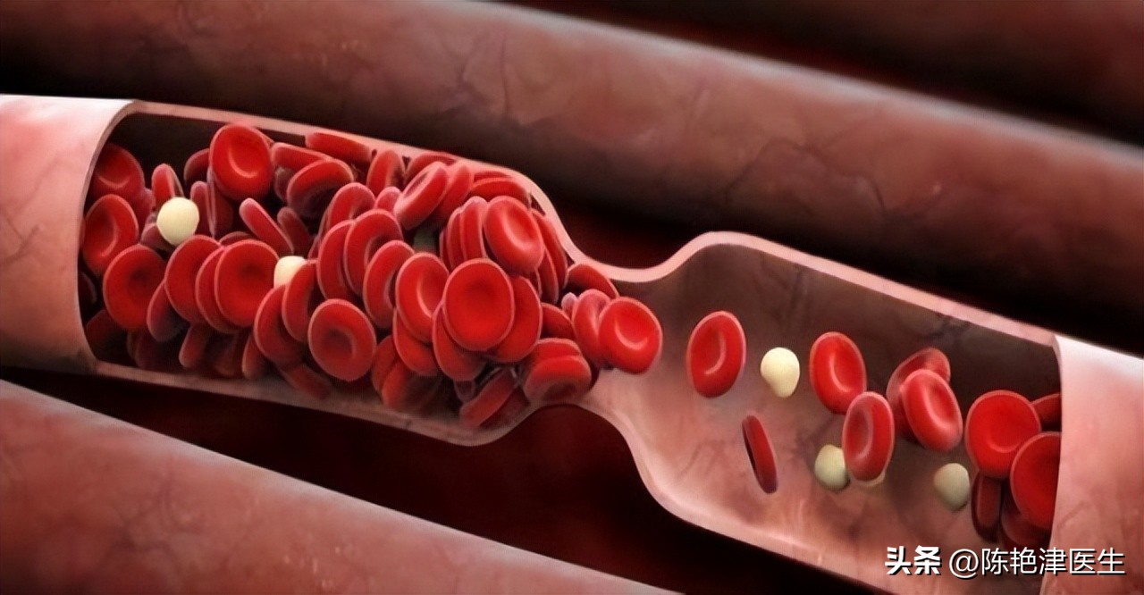 血压的低压偏高是怎么引起的,血压高低压高的原因及解决办法