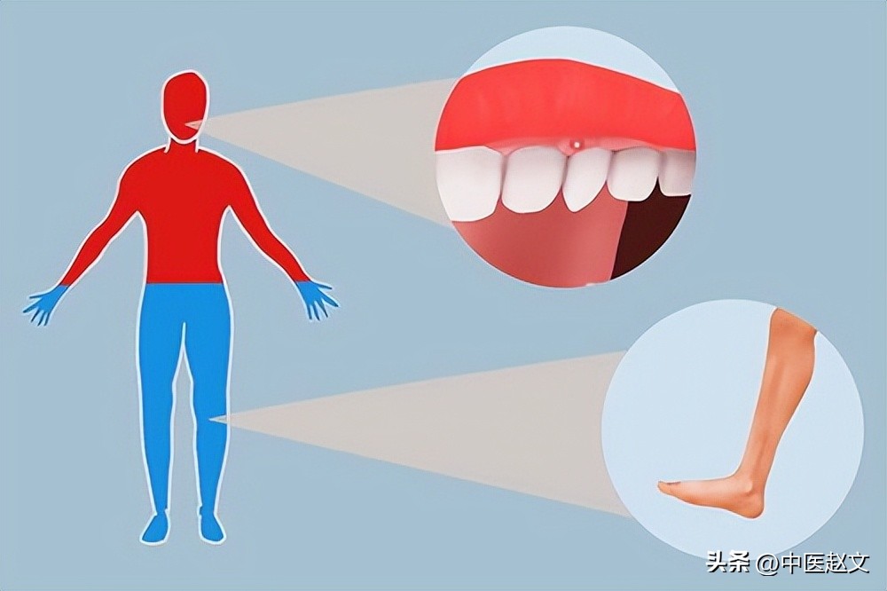 明明体寒却又容易上火,张仲景治疗上热下寒的经典方子