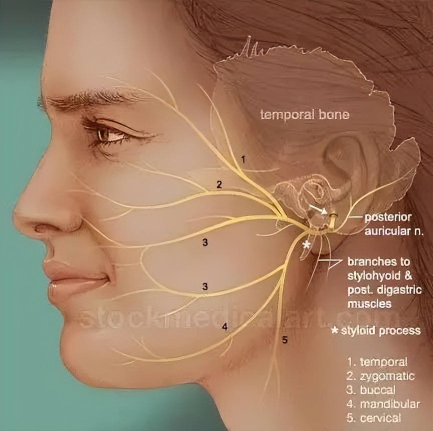 面瘫治疗难不难,面瘫流眼泪怎么治疗