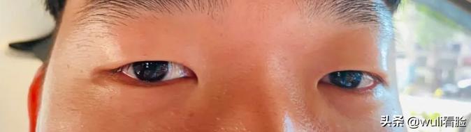 男生割双眼皮的意思,男生眼睛小割双眼皮会好看吗