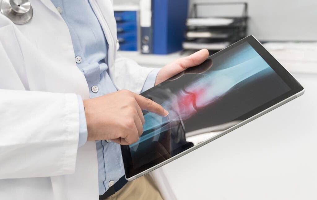 氨糖对关节发软真的有用吗,氨糖到底是不是智商税