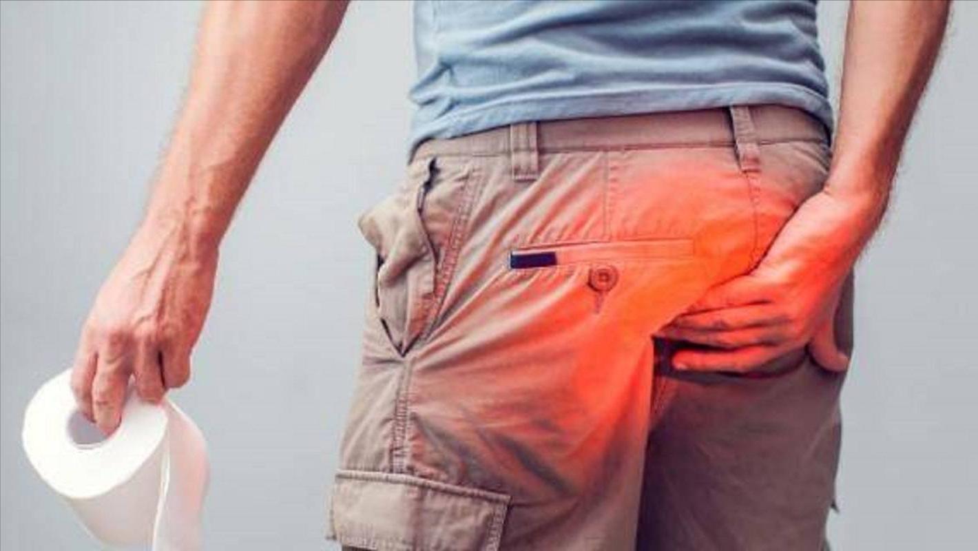 使用痛痒消洗剂治疗混合痔患者术后创面水肿，在临床上疗效如何？