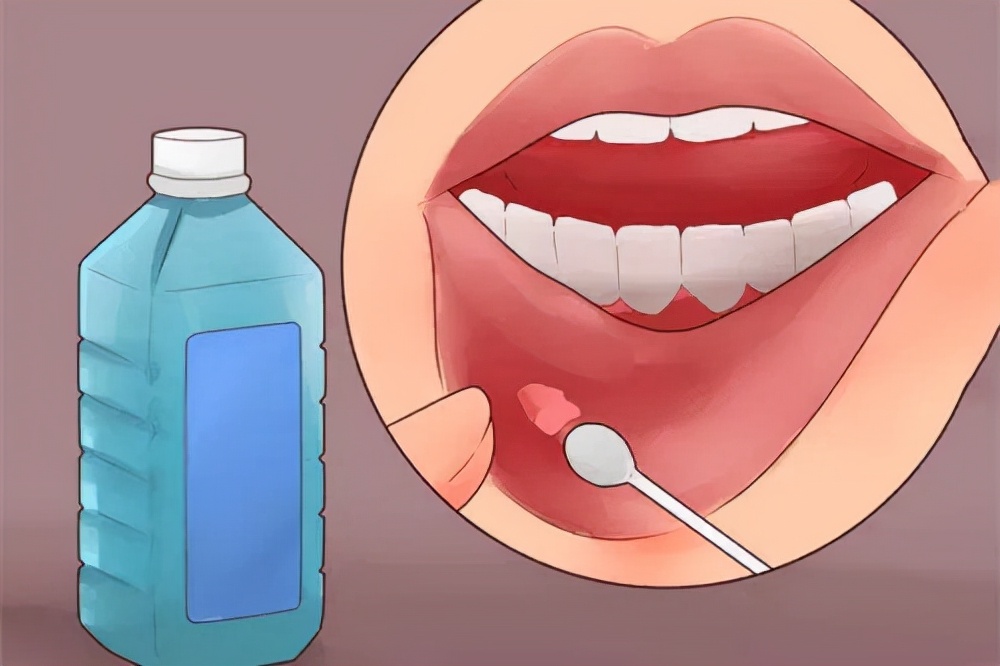 癌症病人白细胞低得住院治疗吗,癌症患者白细胞高怎么降下来最快