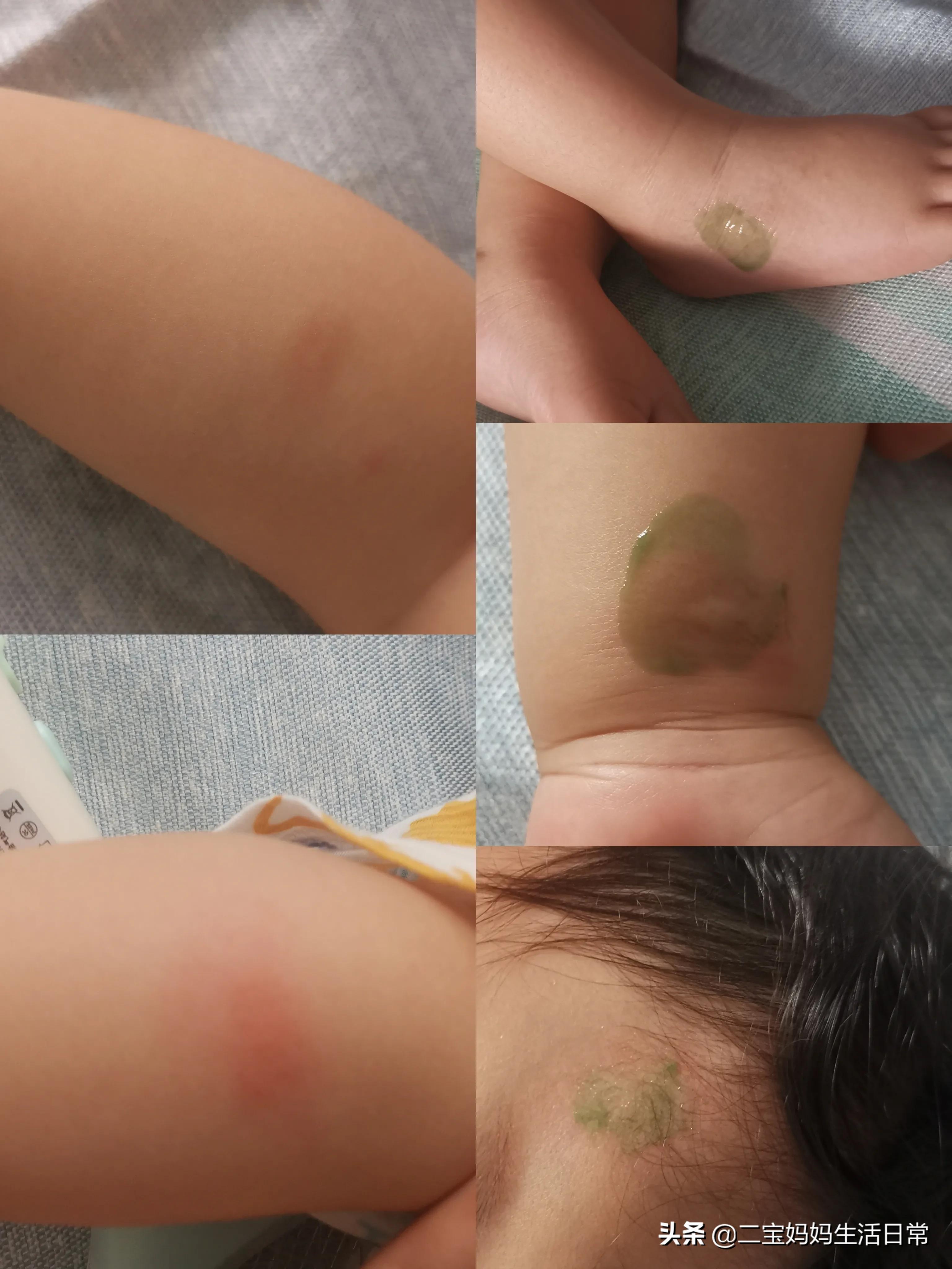 宝妈亲身经历来告诉你真相,婴儿冰丝凉席要不要买