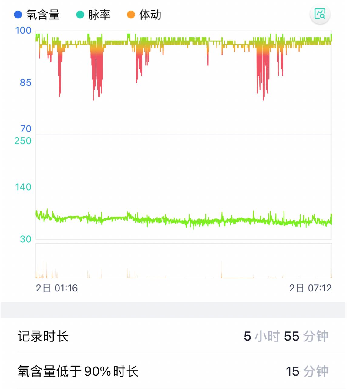 瑞迈特呼吸机2万元左右,乐普呼吸机最好的是哪款