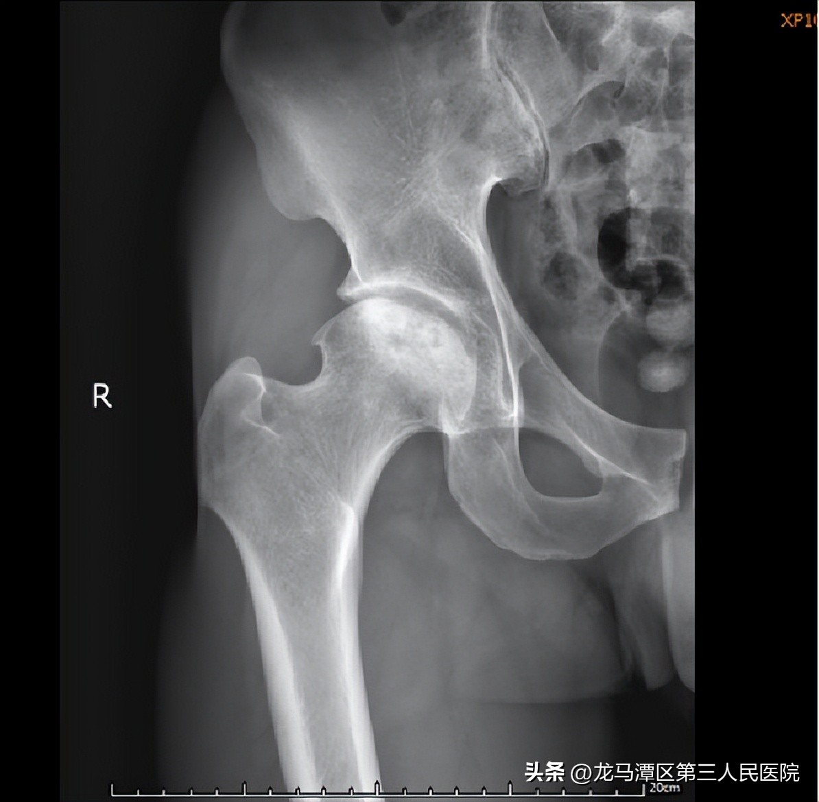 【专家讲堂】区三人医郝琦副教授受邀中国中西结合学会国家继续教育项目