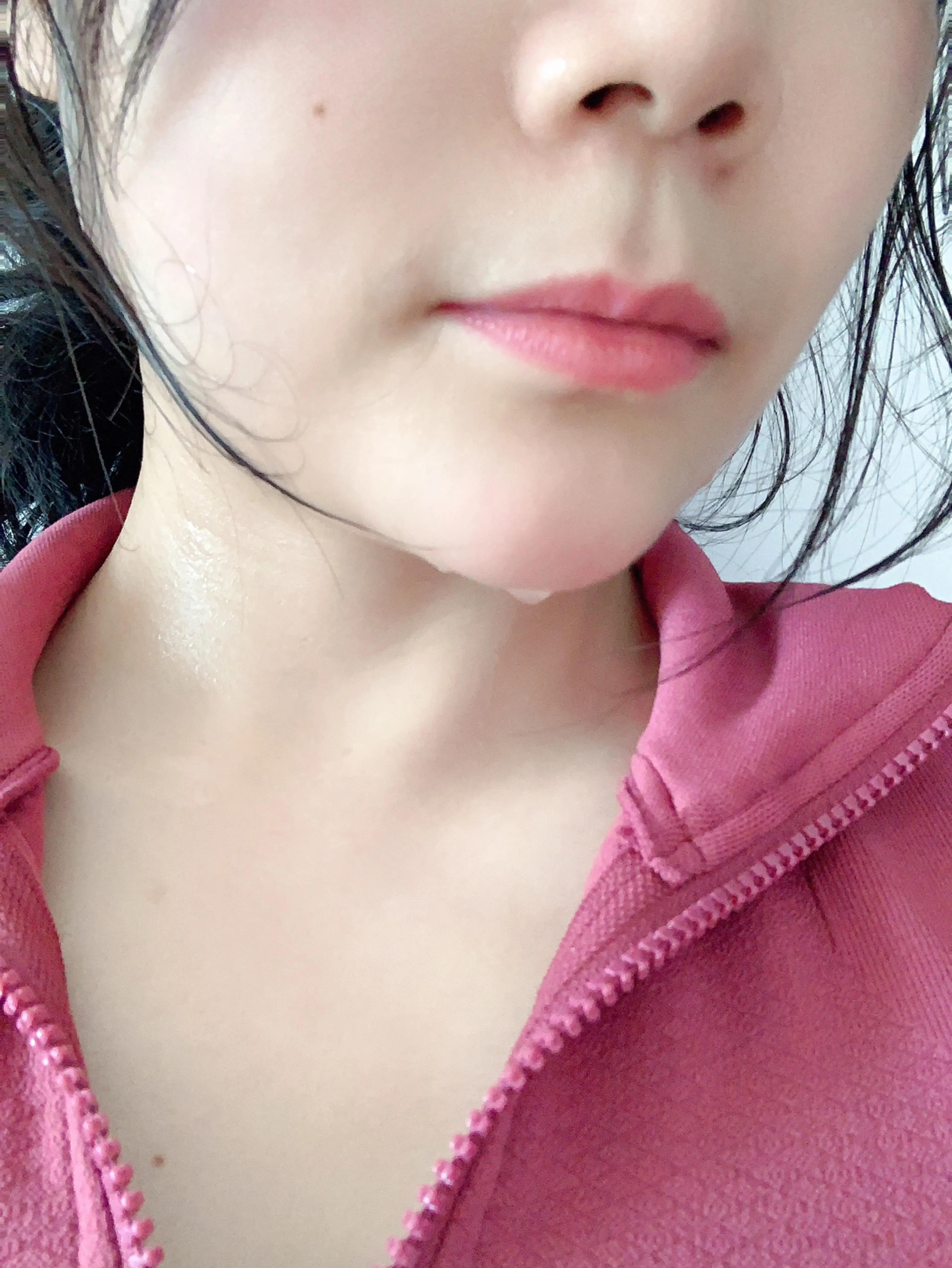 卵巢囊肿生活调理,卵巢囊肿患者冬季需学会养生