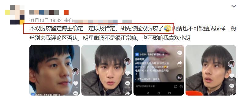 周星驰割双眼皮访谈,周星驰割双眼皮前的电影