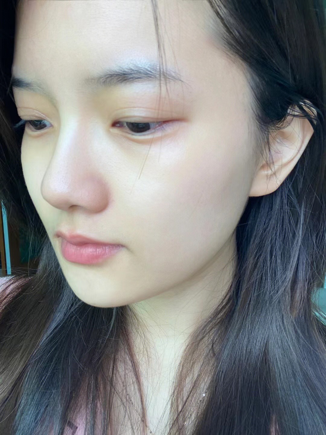 29岁脸上老是长痘痘是什么原因,脸上从来不长痘突然长痘怎么回事