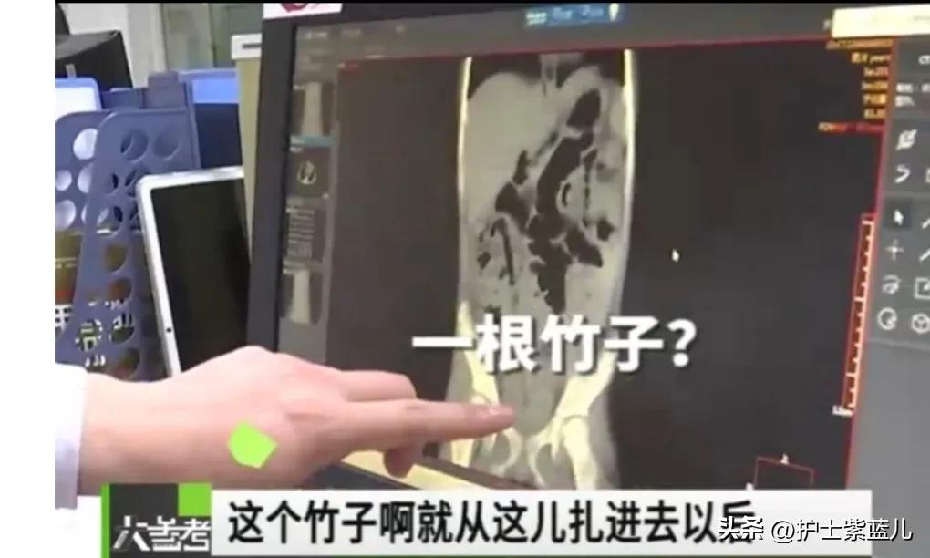 老人从高处跌落昏迷,老人不慎从台阶摔下躺在地上