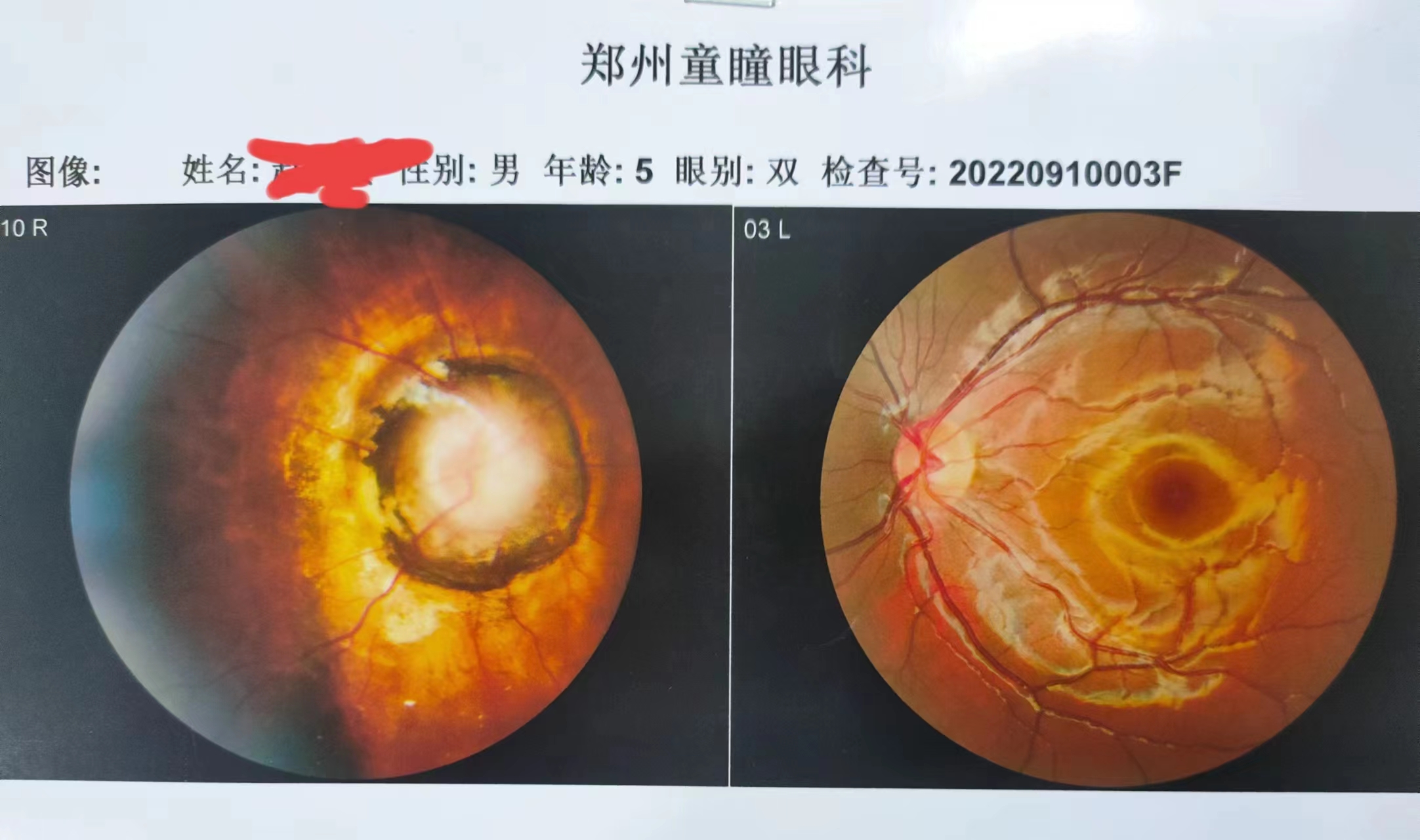 一面锦旗见证8年暖心医患情,锦旗传递浓浓医患情