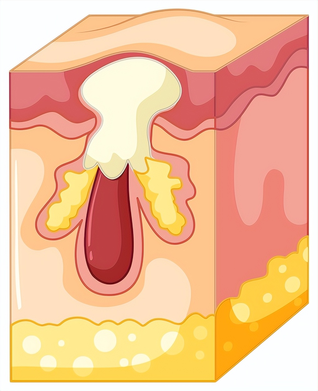 脸上冒痘头皮长痘怎么回事,头皮反反复复长痘是什么原因