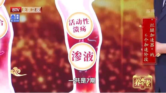 腿酸胀难受怎么缓解静脉曲张,单腿小腿酸胀发麻是静脉曲张吗