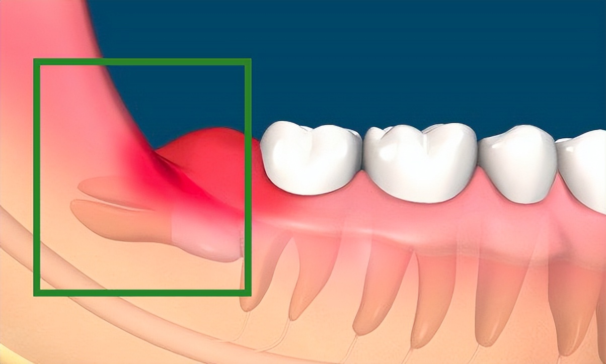 人体无用的6种器官是什么,人体最鸡肋的器官