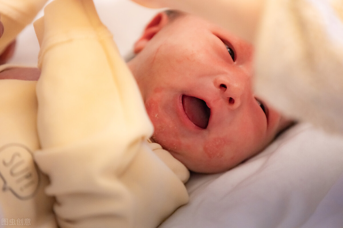 新生儿湿疹怎么治疗最快的方法,新生儿湿疹怎么处理比较快