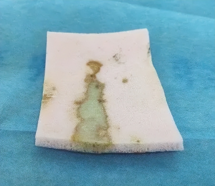 创面外用药物及敷料的使用策略及理论依据