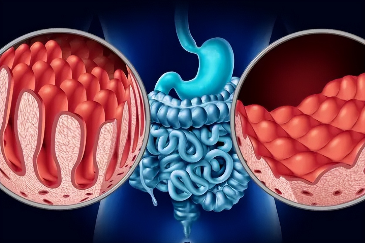 阿莫西林列入十种不能吃的药,阿莫西林别乱吃只对6种病有效