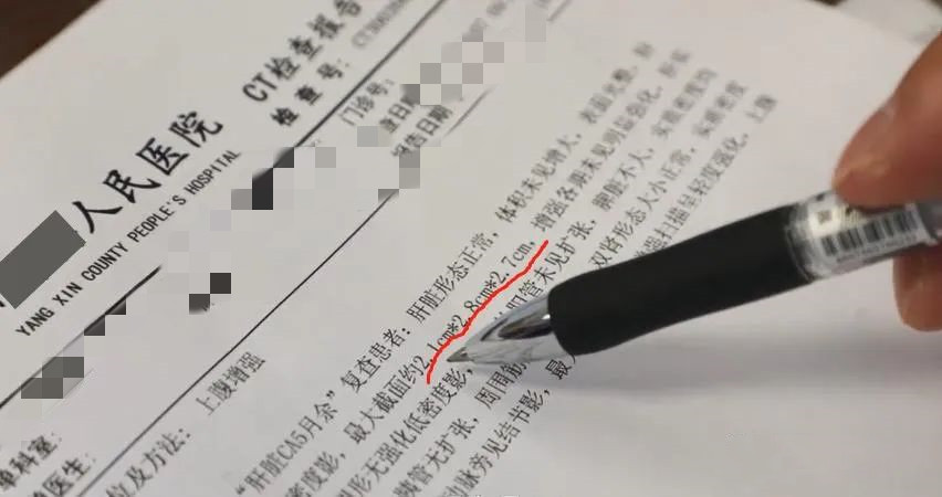 弥漫性肝癌晚期能消融吗,弥漫肝癌治疗后肿瘤会消失吗