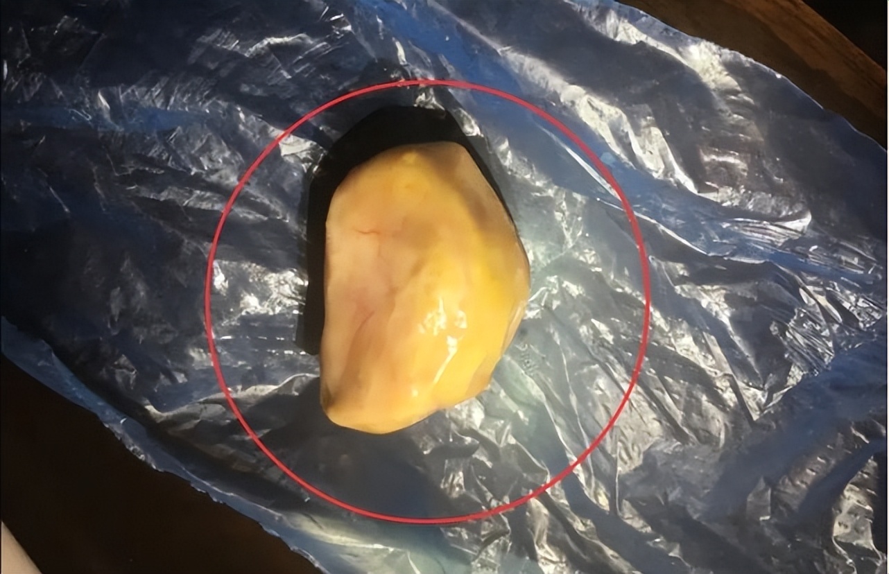 一颗结石,一颗鸡宝能卖多少钱