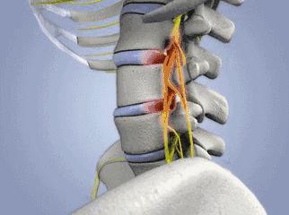 肩关节痛应与什么病鉴别,肩痛有可能是患上哪些病