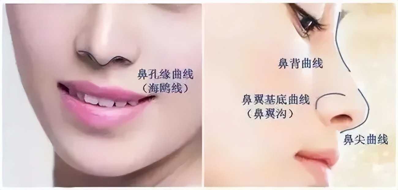 妈生鼻适合所有脸型吗,自然鼻和妈生鼻有什么区别