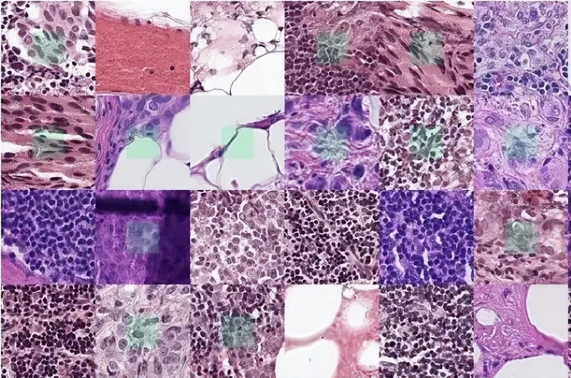 医学影像目标检测框架,开源数据集目标检测