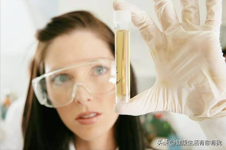 尿完别急着走开，尿液异常气味可能是身体求救信号，千万要留心