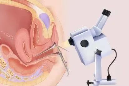 镜观其变作用是什么,镜观之变