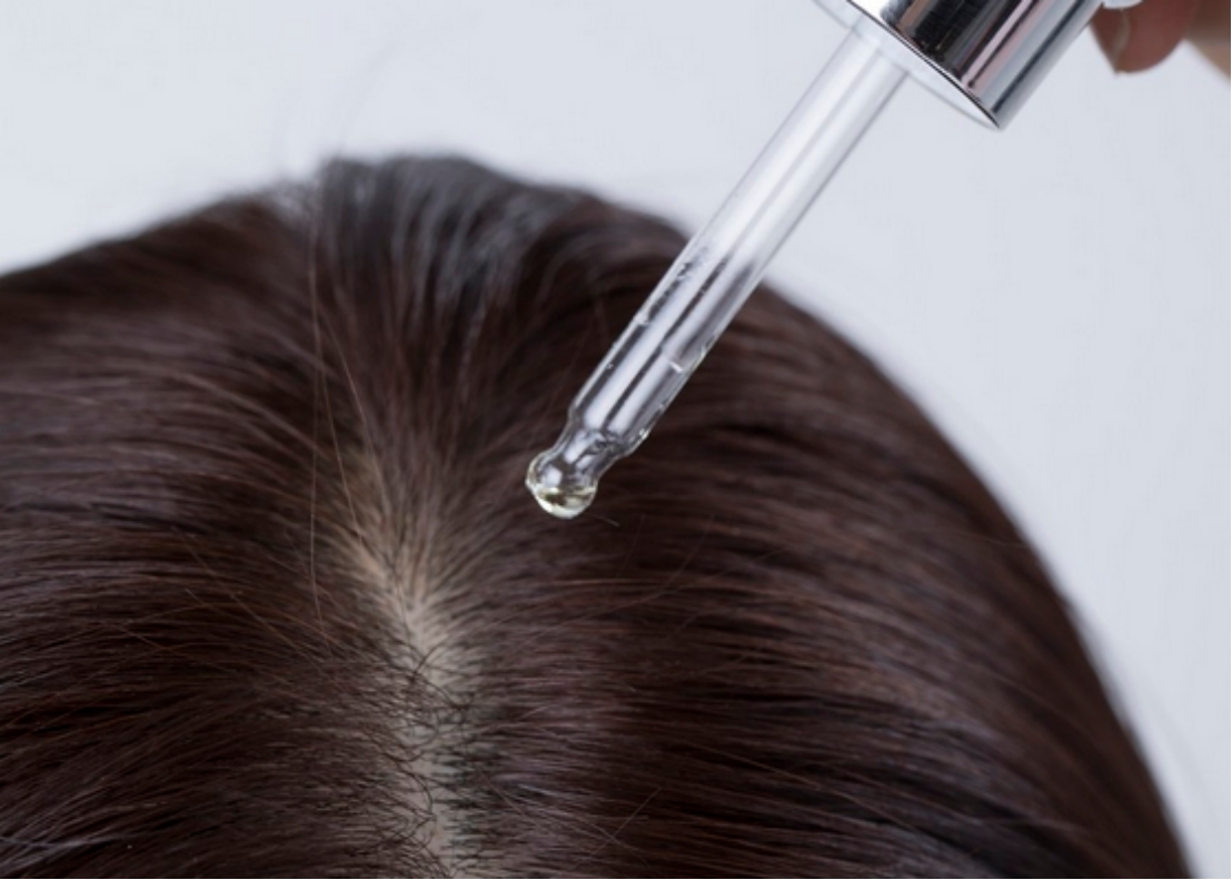 怎么脱发最有效果,怎么样脱发才算严重