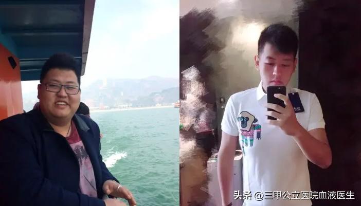 “分手成了减肥特效药”男子分手后为什么能够3个月减肥将近百斤