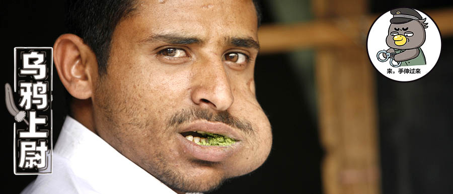 槟榔成瘾的国家,沉迷槟榔应该怎么戒呢