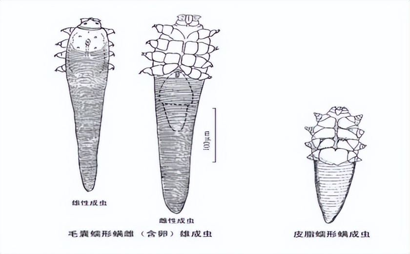 除螨公司品牌前十名,什么品牌除螨仪除螨效果好